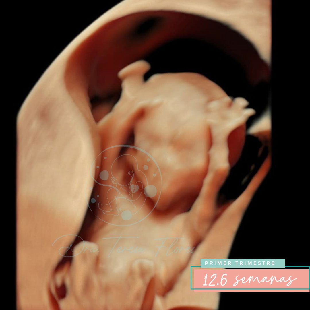 Teresa Miriam Flores Amador-7