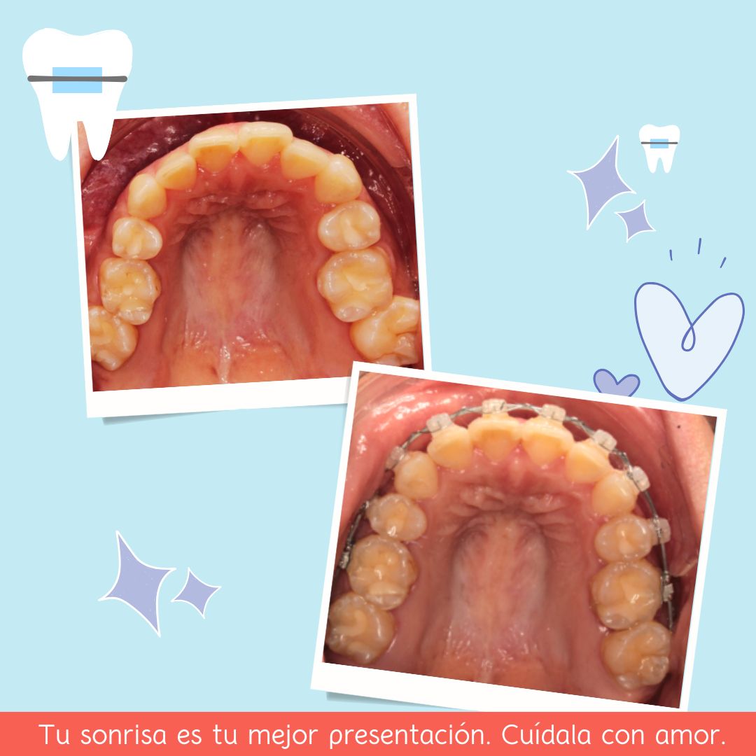 Nora Gabriela Loranca Moscosa-1
