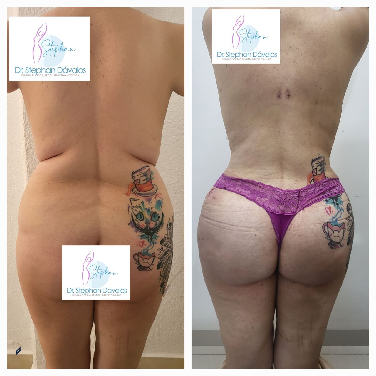 Stephan Dávalos Barrios-3