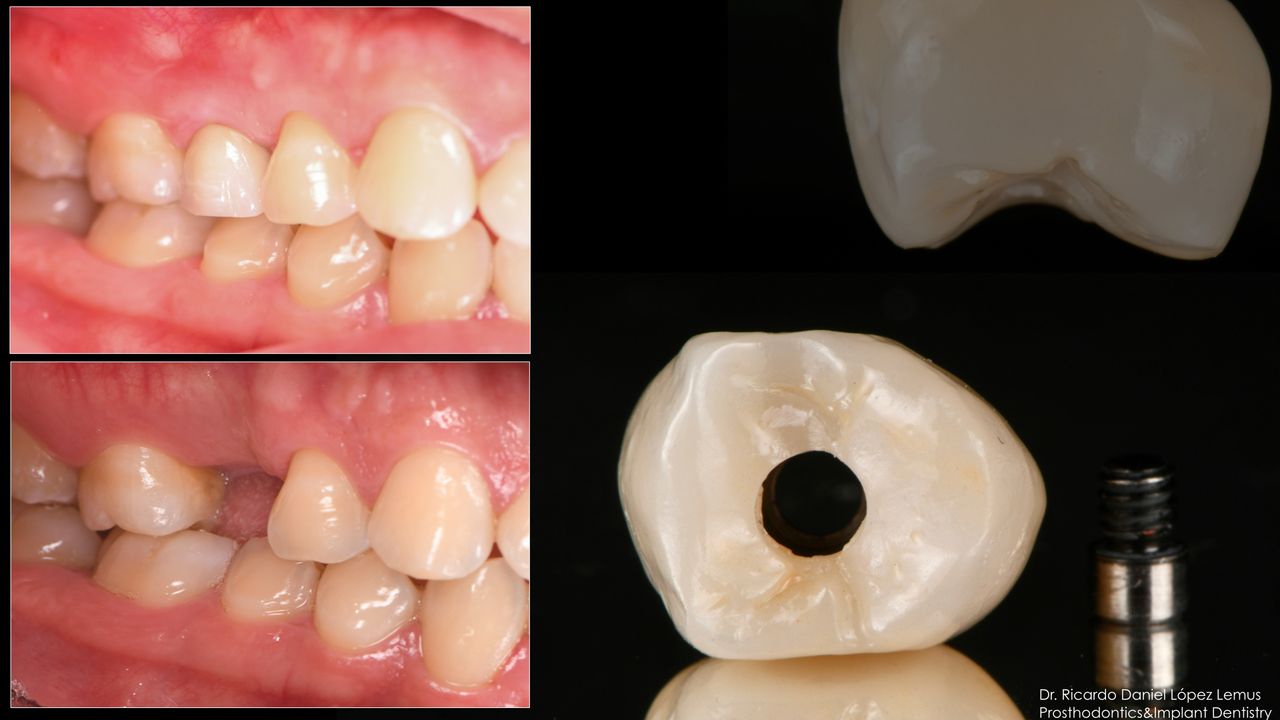 Ricardo López Lemus-43