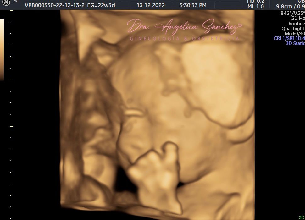 Angélica Ma. Sánchez Castro-9