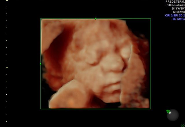 Graciela Elizabeth De La Torre Alvarez-14