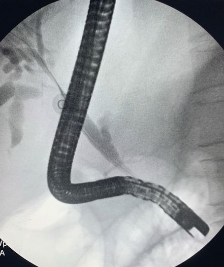 Esteban Bueno Lavandeira-7