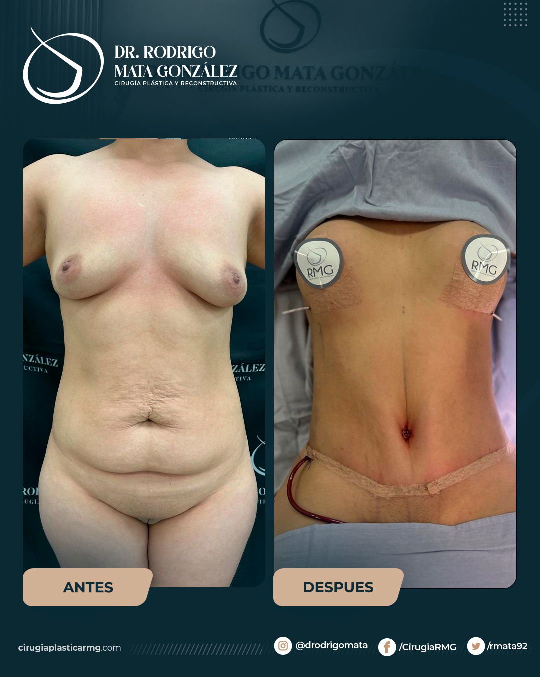 Rodrigo Mata Gonzalez-23