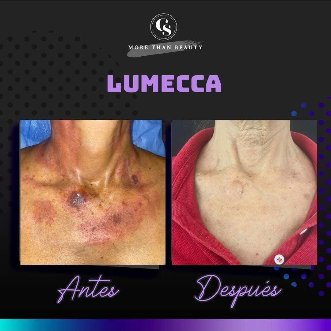 Diana Hannah Carreon-11