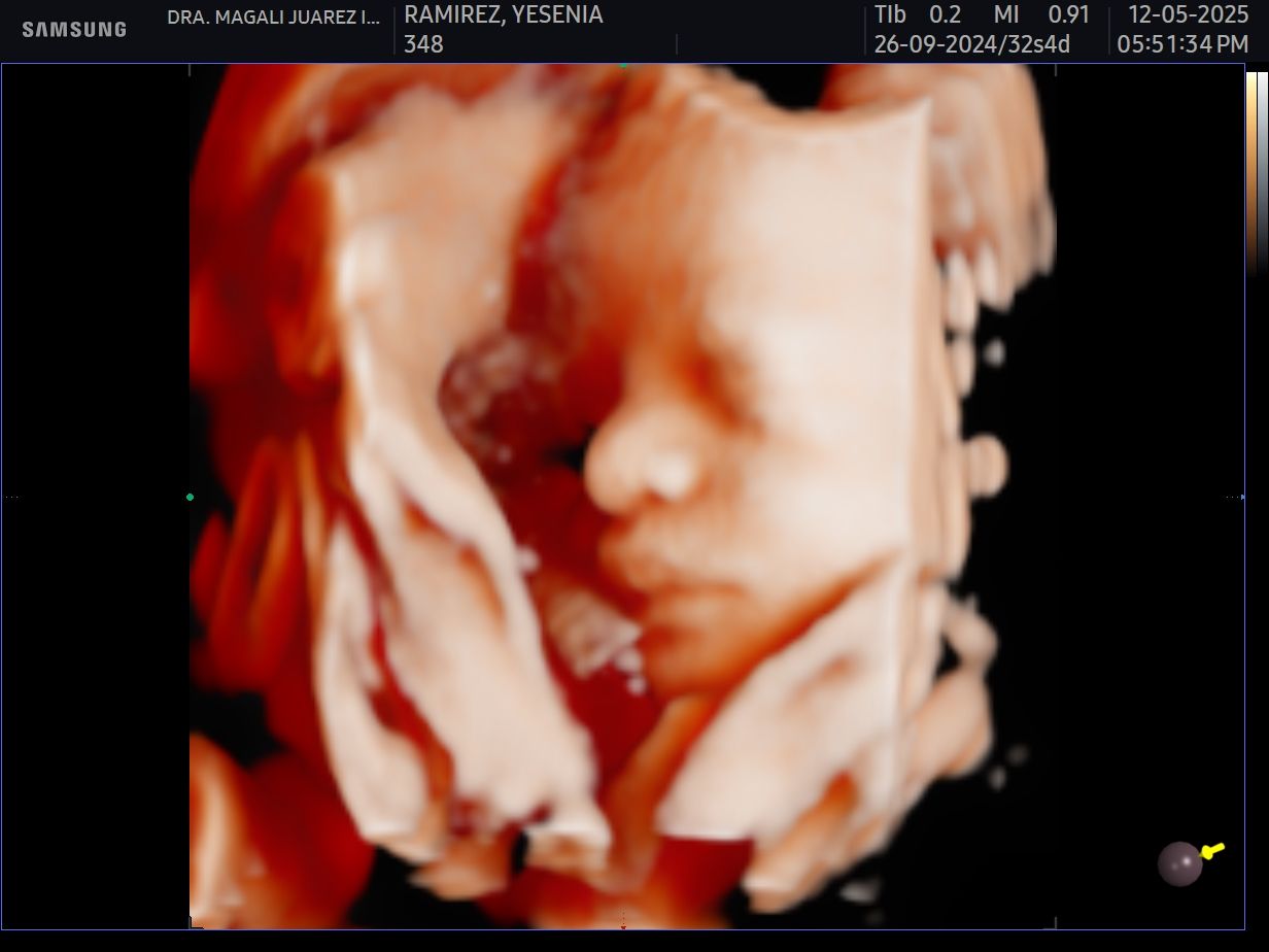 Magali Araceli Juárez Ibarra-0