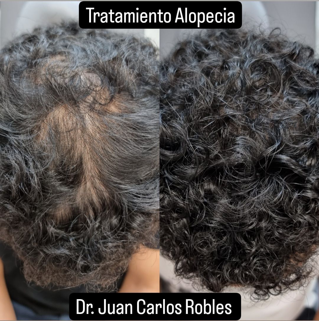 Juan Carlos Robles Méndez-2