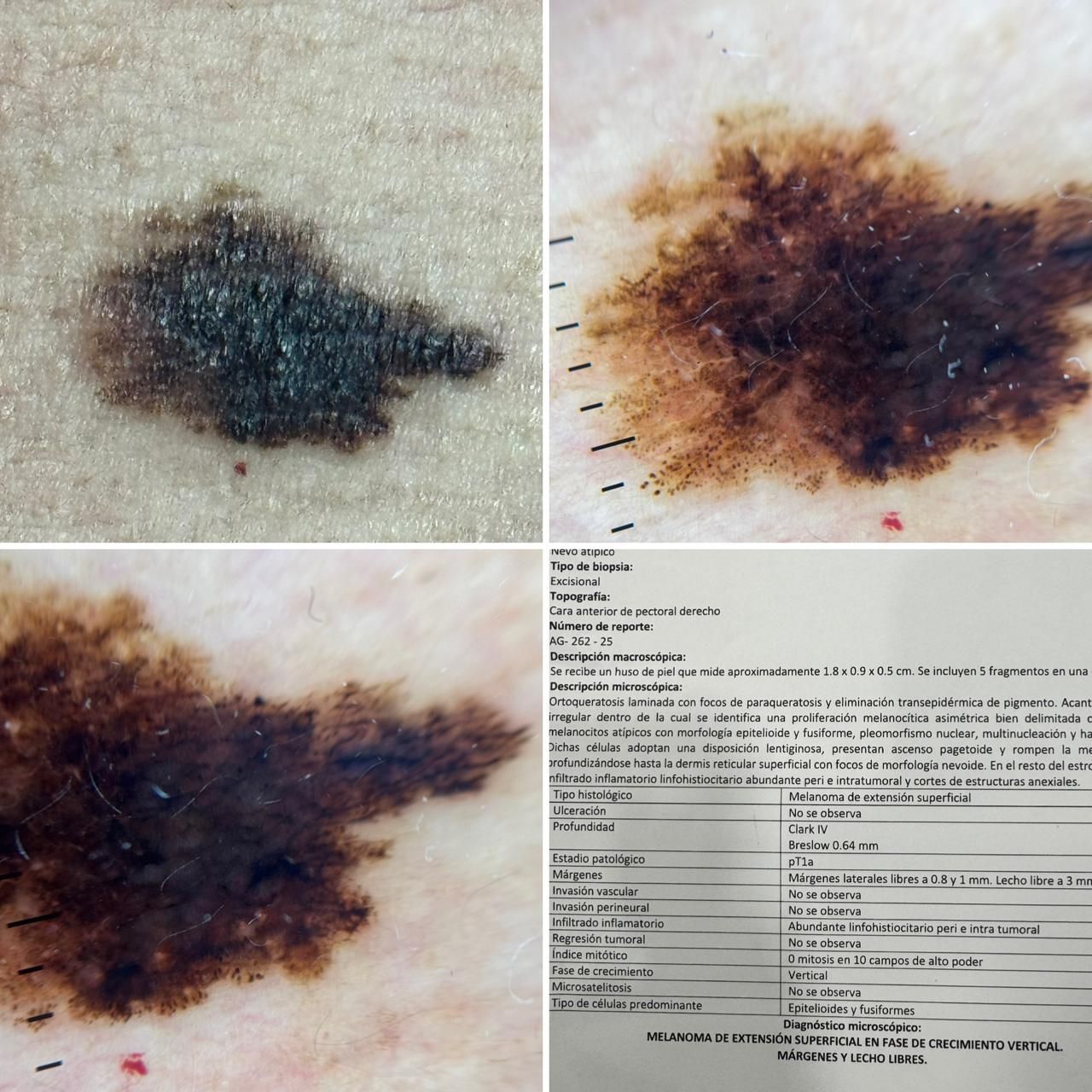 Ana Gabriela Souza Suarez Medrano-11