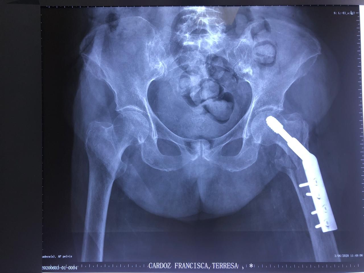 Alejandro Murillo Villarino-0