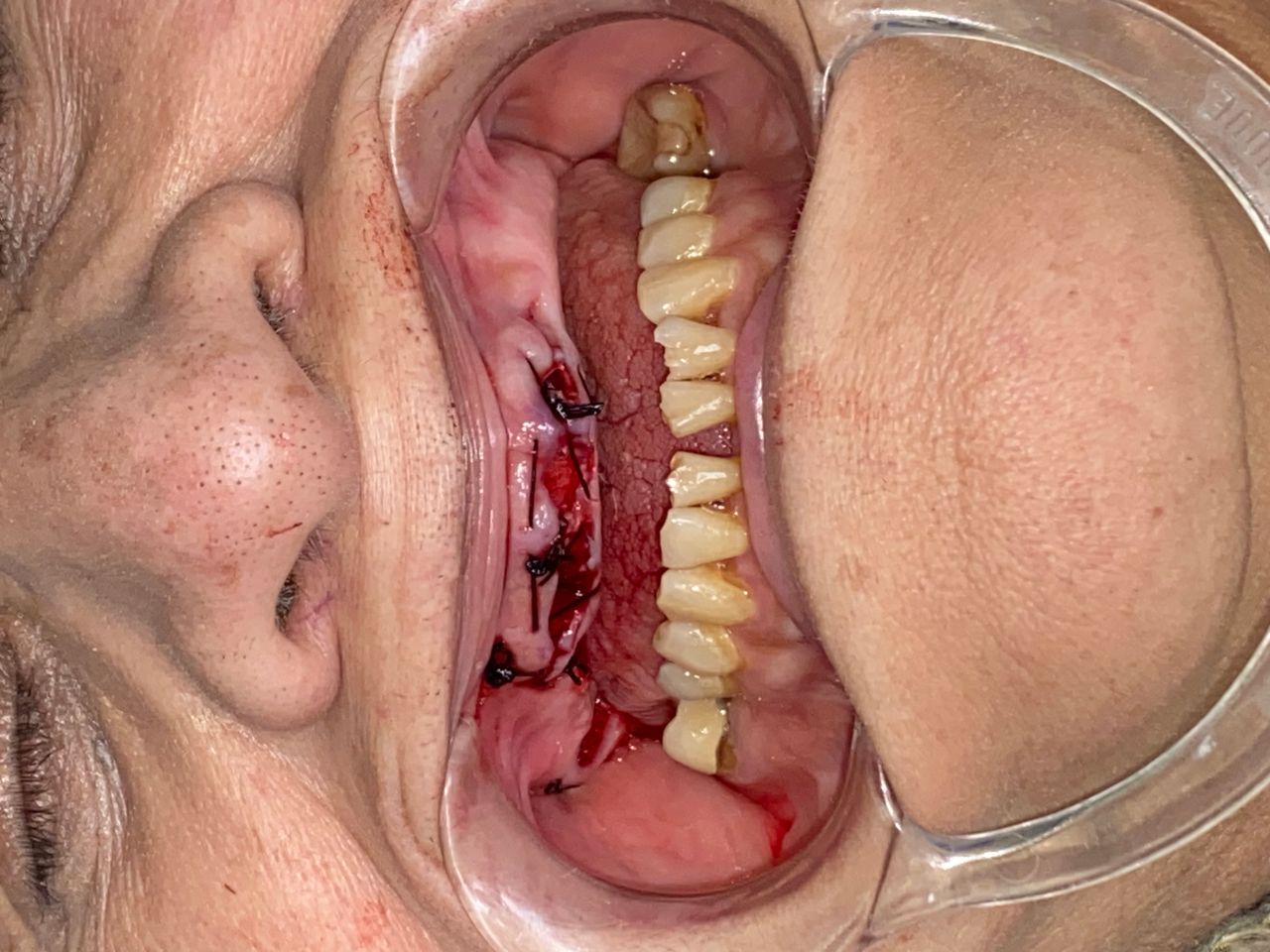 Raúl Méndez Cifuentes-14