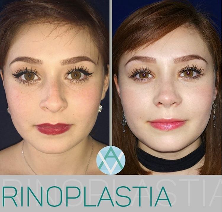 Alfonso Villaseñor Herrero-13