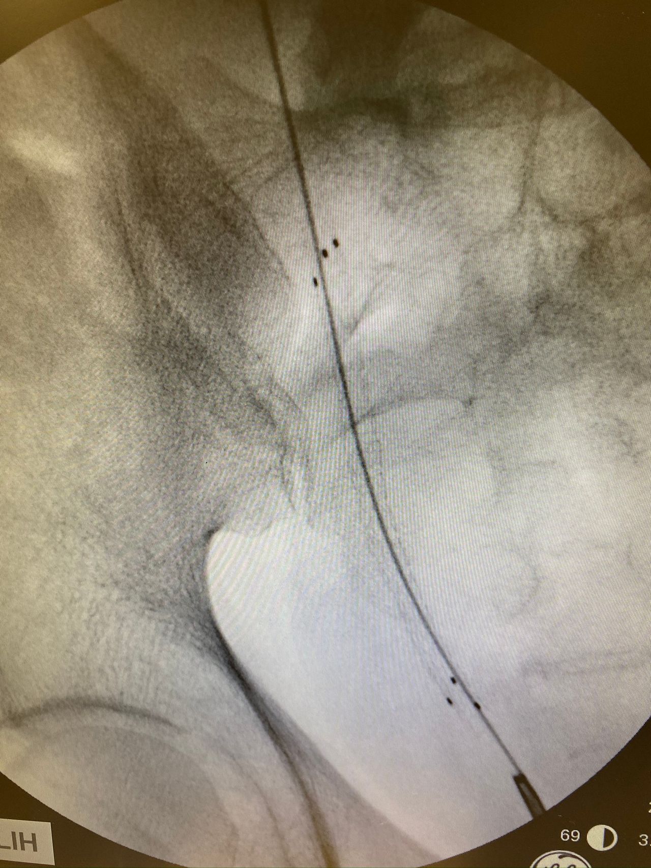 Roberto Juvenal Pérez Avila-3
