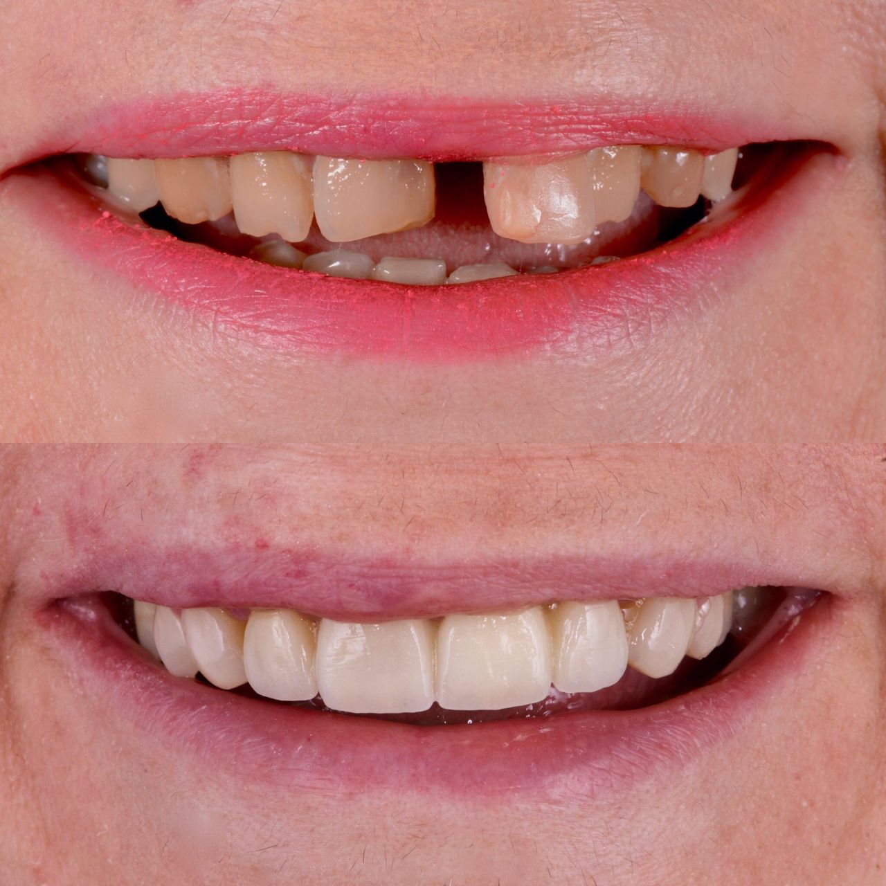 Mauricio Villegas Akena-16