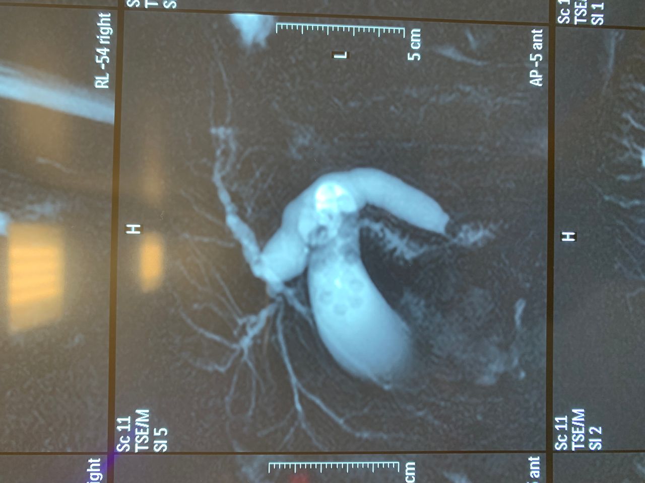 Edgar Raziel Acosta May-11