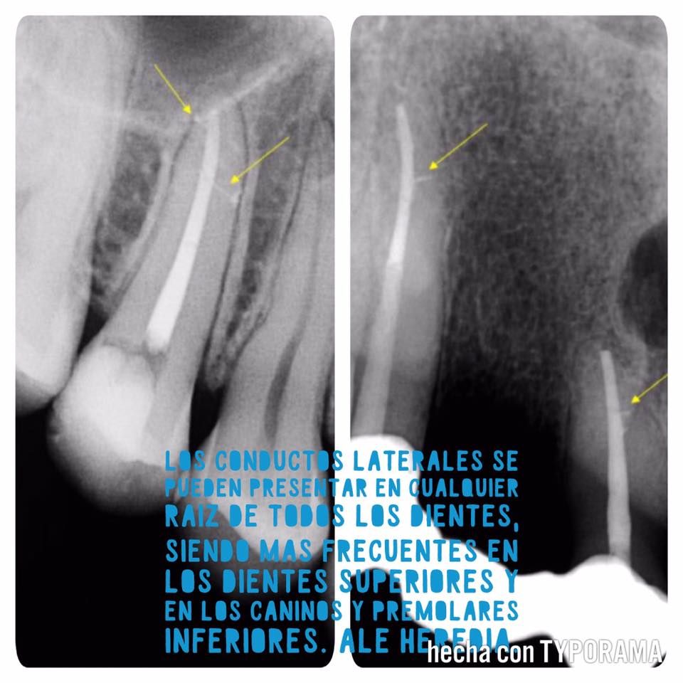 Alejandra Heredia Morán-21