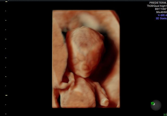 Graciela Elizabeth De La Torre Alvarez-19