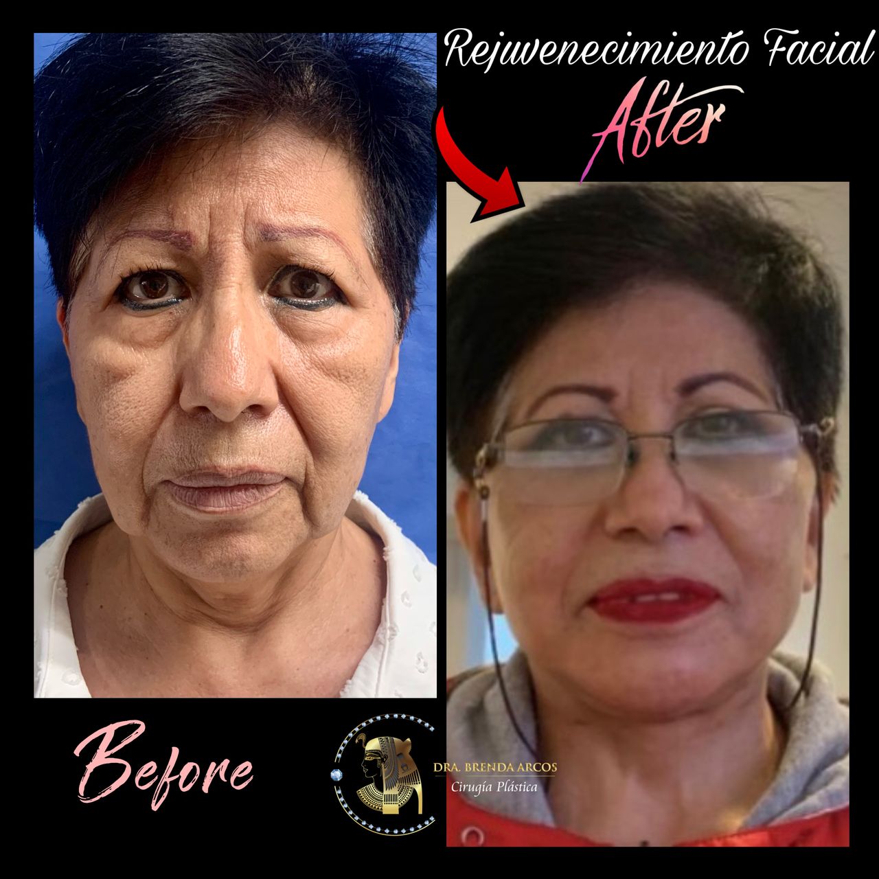 Brenda Arcos Vera-26