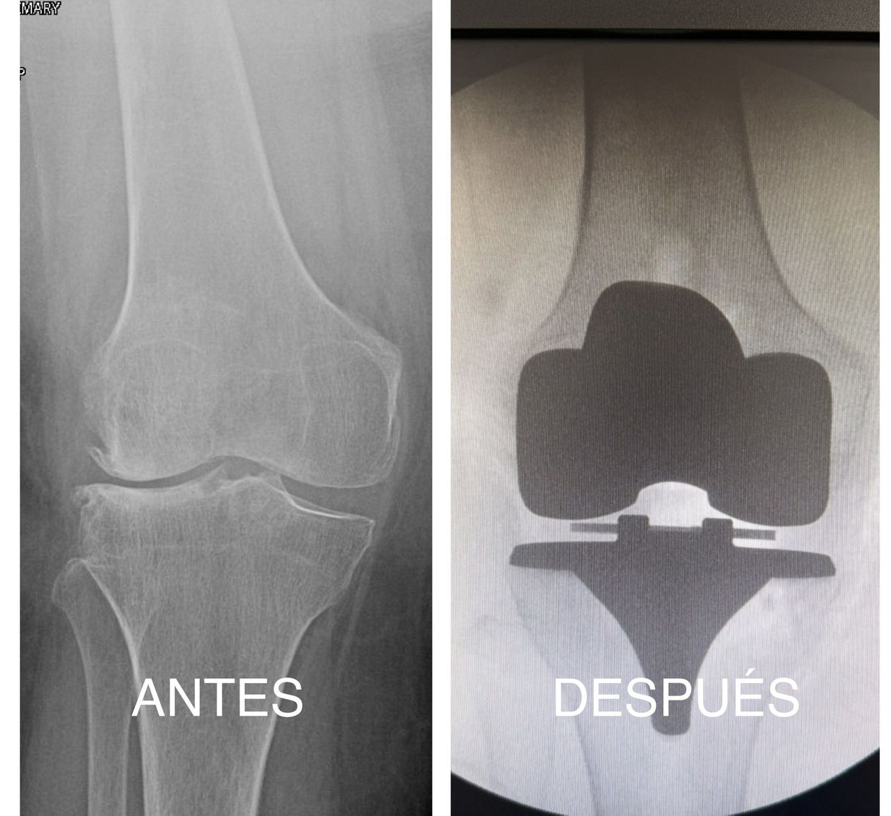 Luis Miguel Pacheco-8