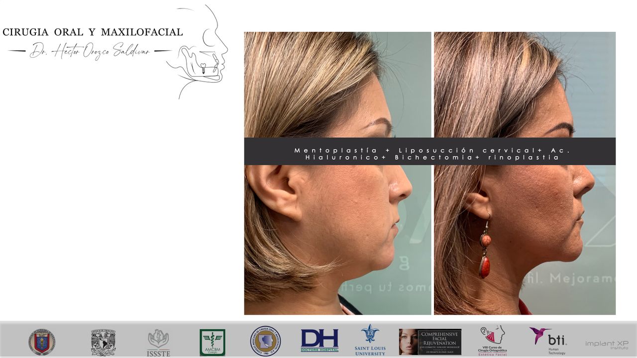 Héctor Adolfo Orozco Saldívar-34