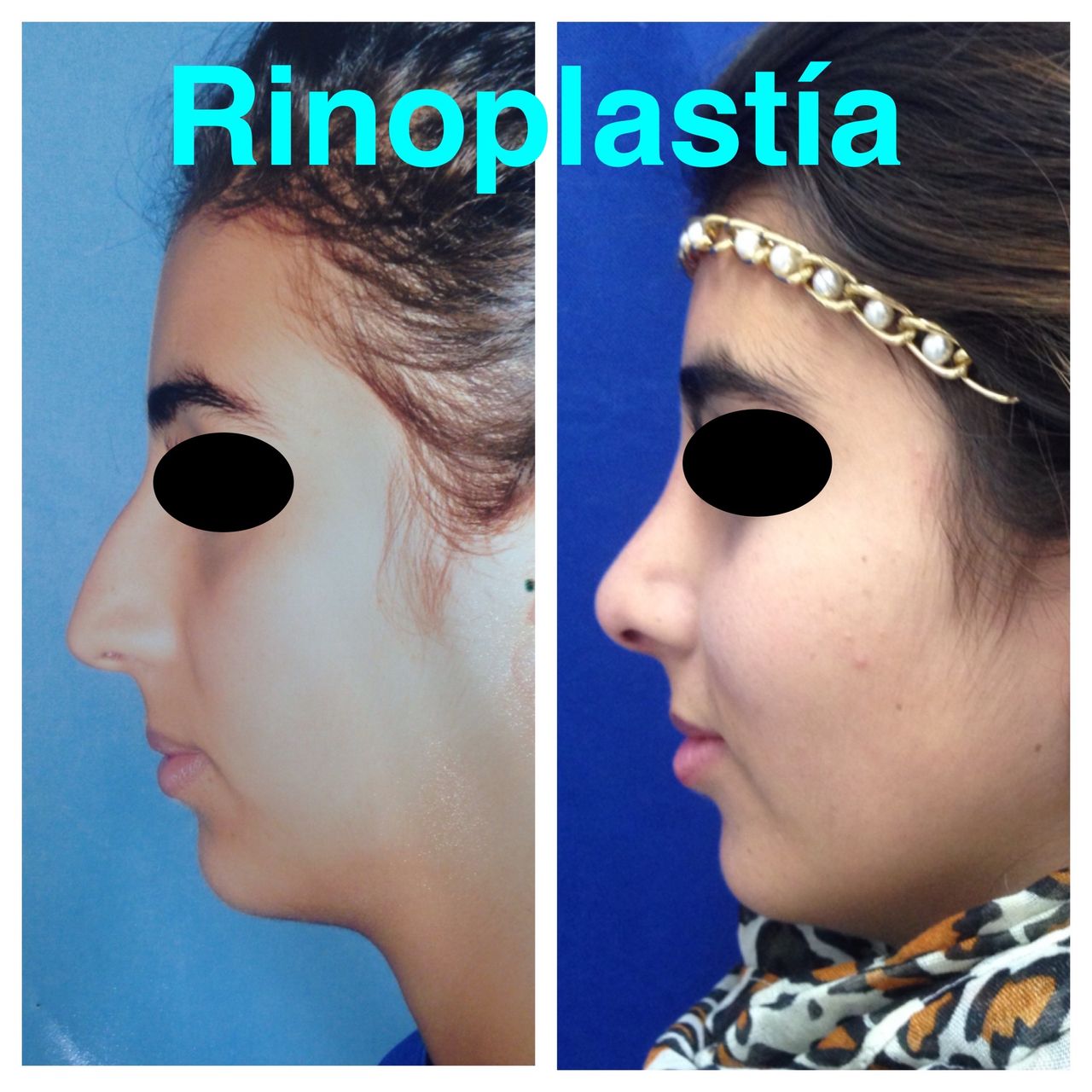 Ubaldo Carpinteyro Espín-4