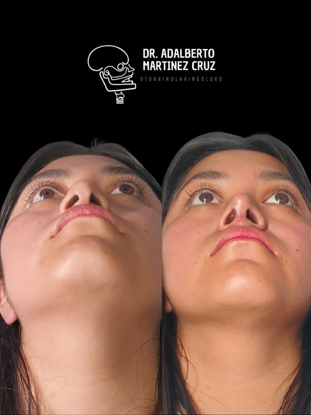 Adalberto Martínez Cruz-13