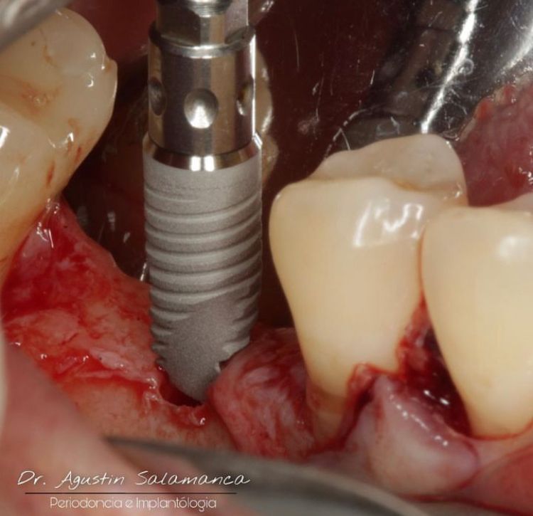 Agustin Salamanca Tapia-12