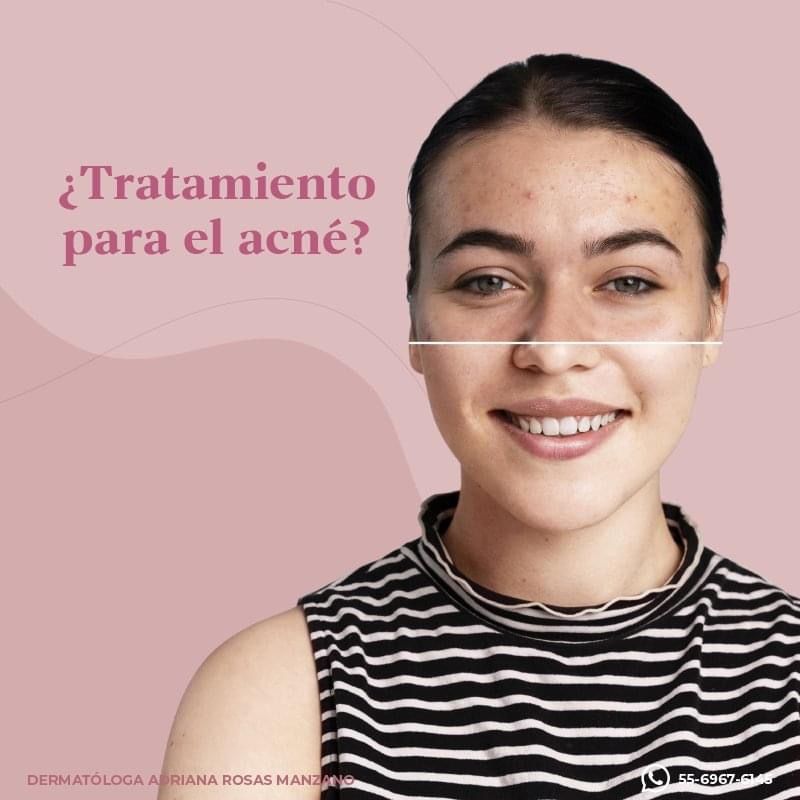 Adriana Rosas Manzano-5