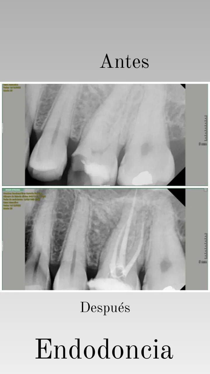 Zury Sarai Moreno Soto-30