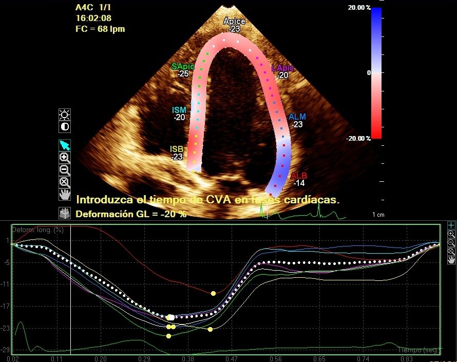 Heriberto Pruneda Ayala-18