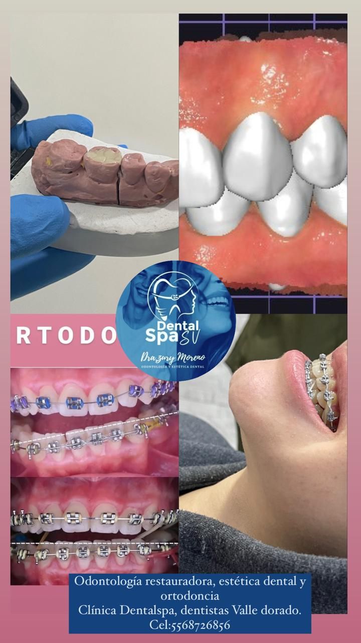 Zury Sarai Moreno Soto-17