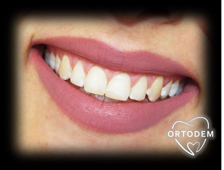 Elizabeth Morelos Morales-0