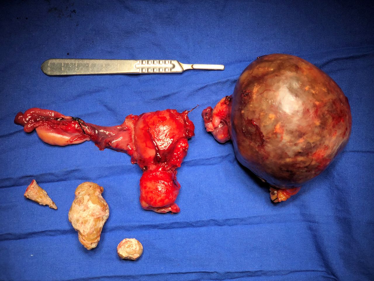 Hugo Kaleb Encorrada Luarca-11