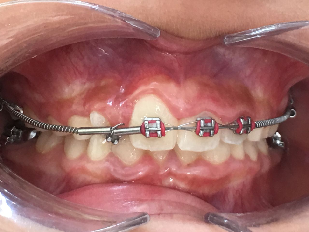 Patricia Rizo Palos-3