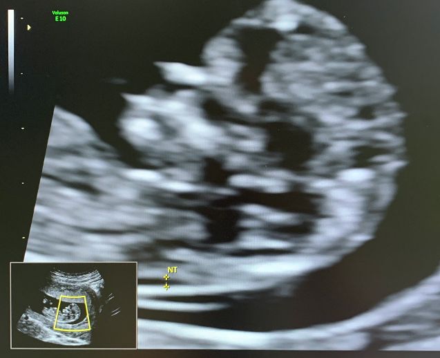 Susana Soto López-7