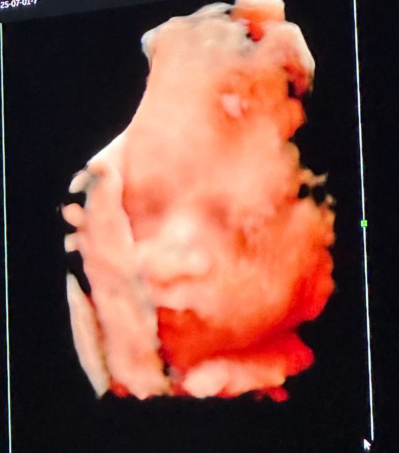 María Teresa Flores Molina-14