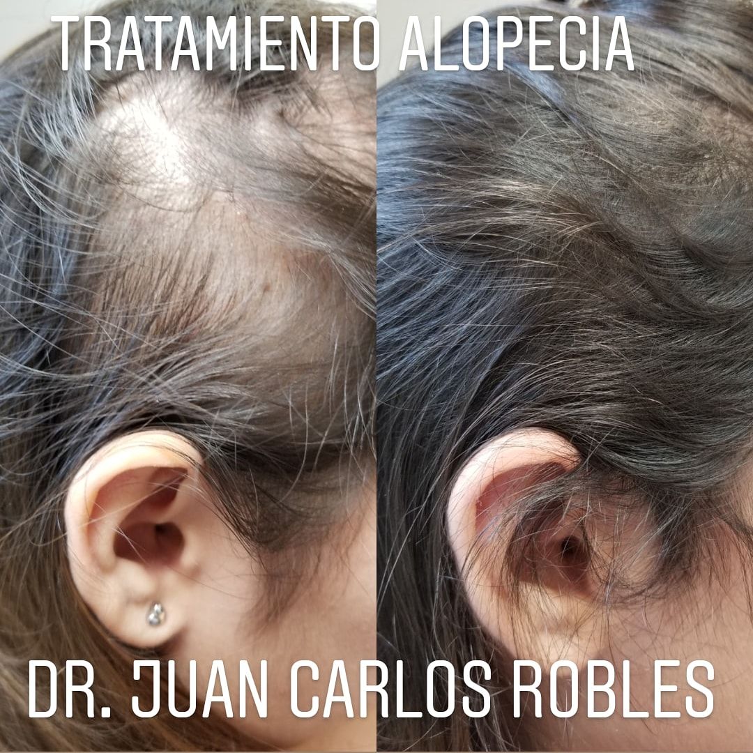 Juan Carlos Robles Méndez-5