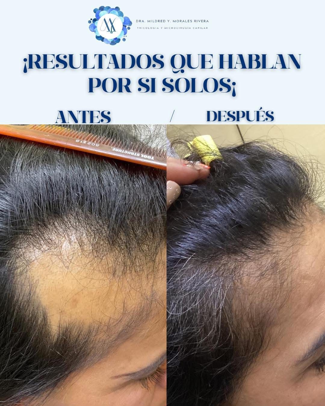 Mildred Yasmin Morales Rivera-3