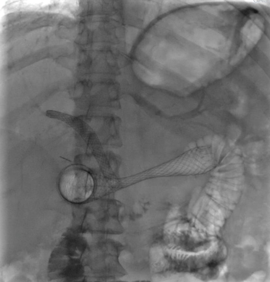 Everardo Muñoz Anaya-9