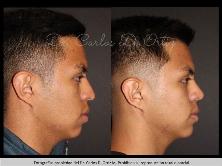 Carlos David Ortiz Moreno-35