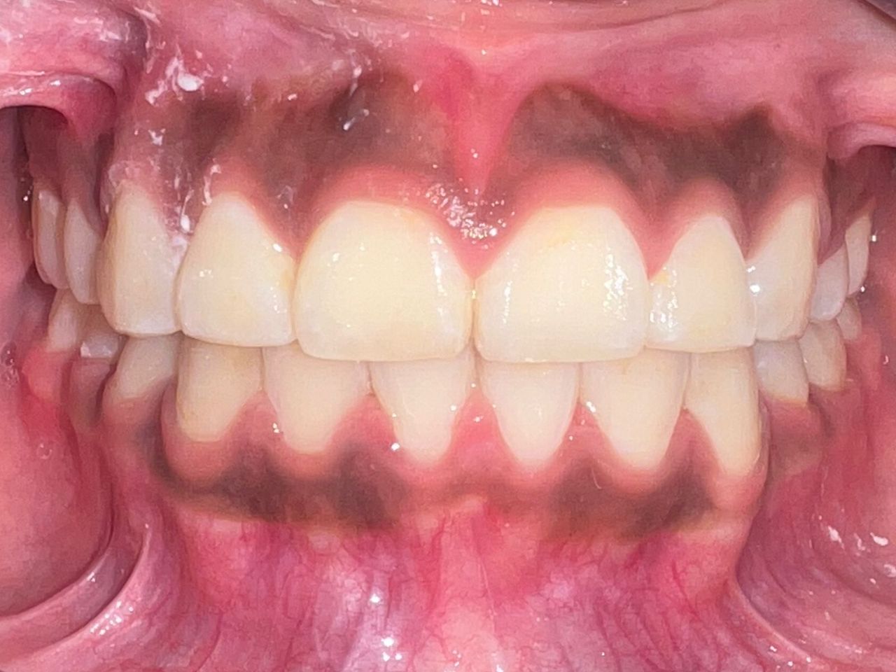 Jair Contreras García-43