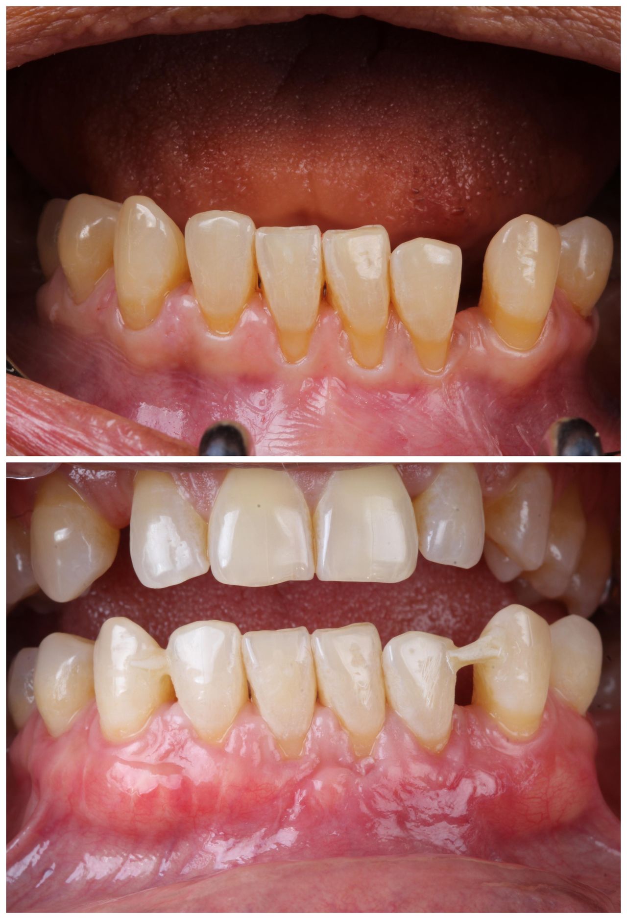 Hugo Enrique Aguilar Lamas-96