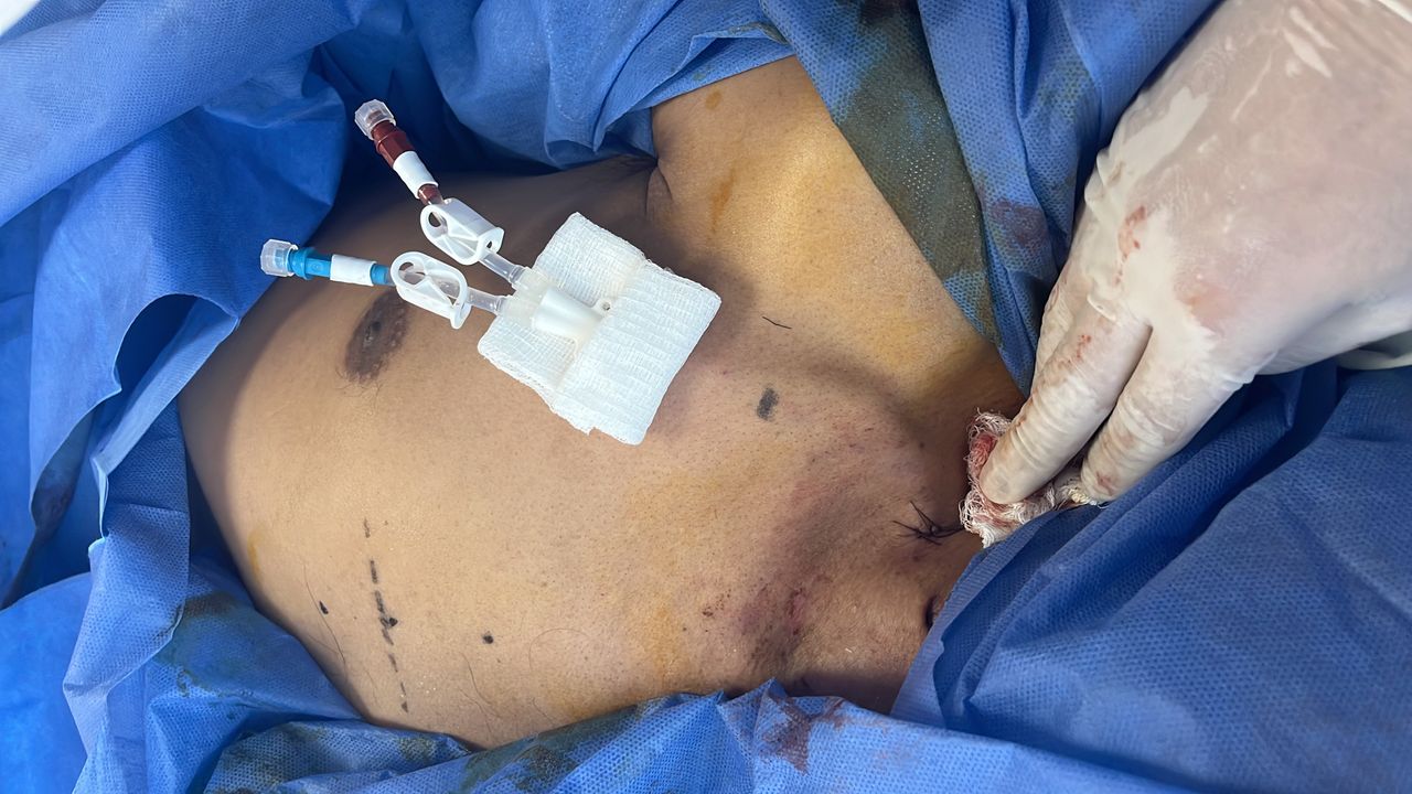 Miguel Angel Rojas Santiago-2