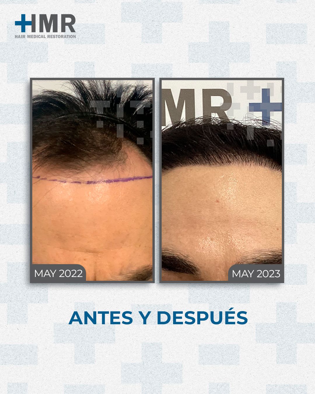 Jorge Keity Cortez Barrón-4