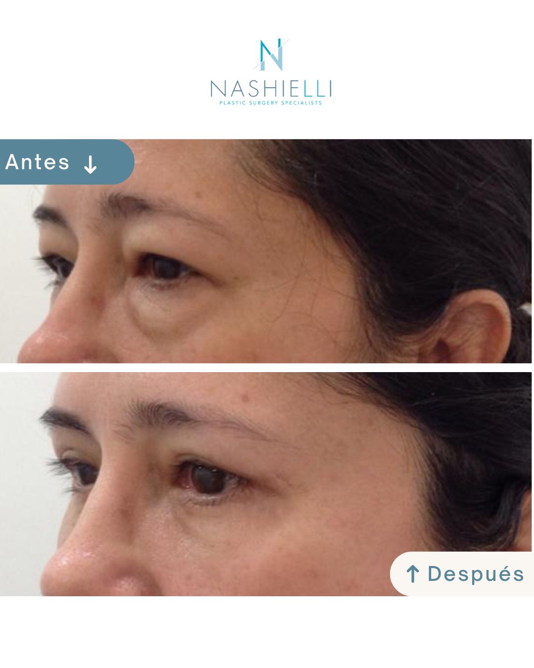 Nashielli Torres Espinosa Chiu-32