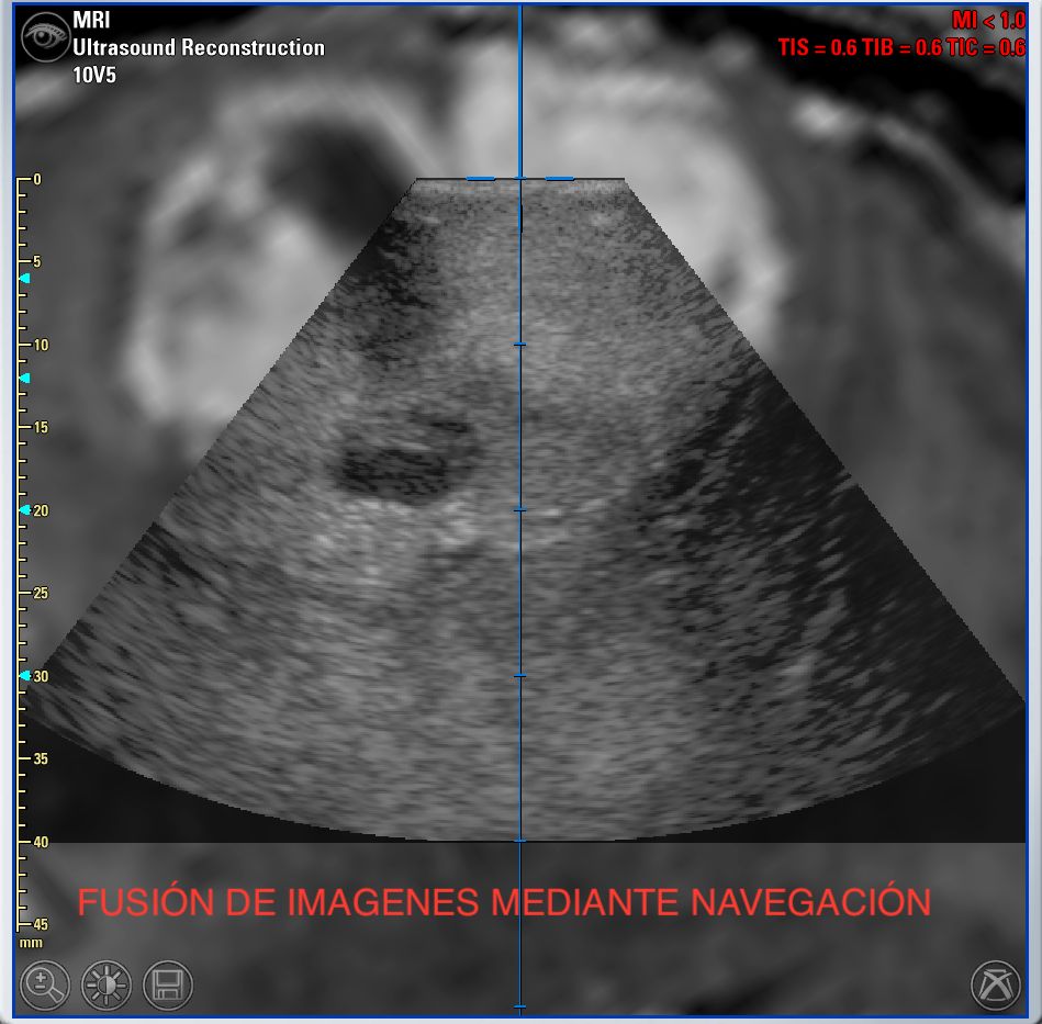 Enrique De Obieta Cruz-37