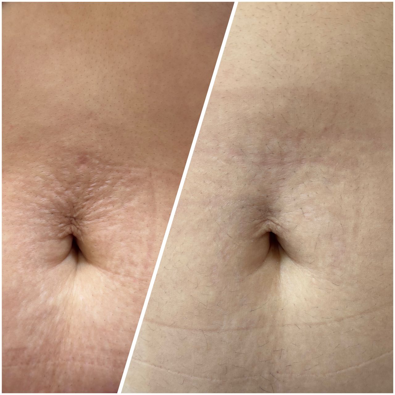 María Xosé Arroyo López-4