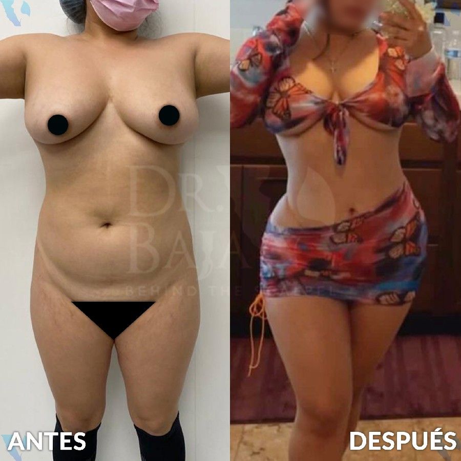 Renato Rodríguez Hirales-36