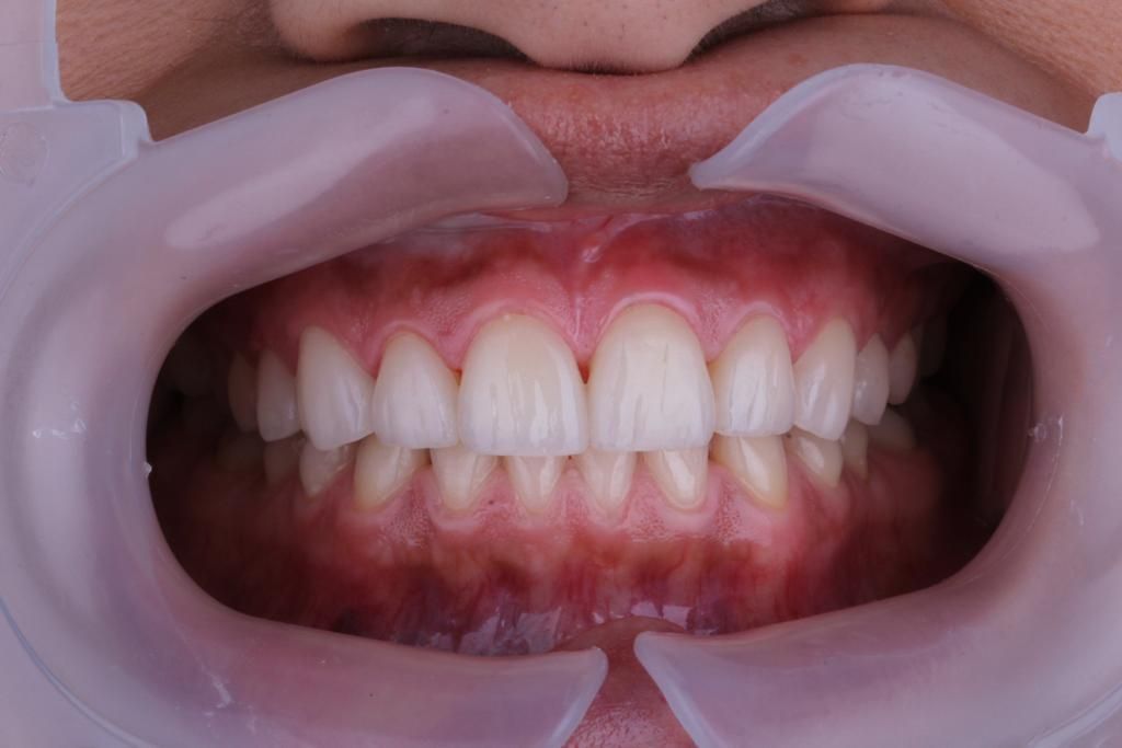 Josué Márquez Gómez-49