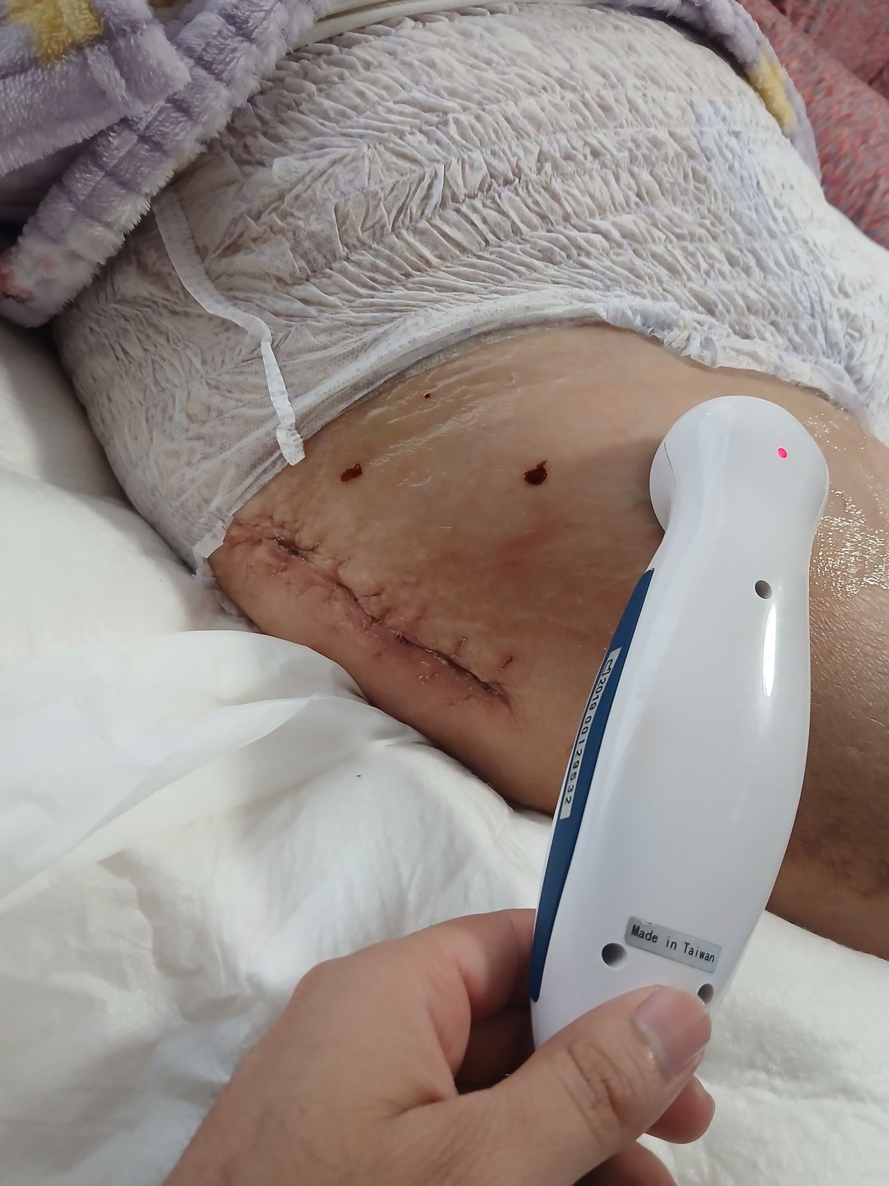 Abel Pastrana Nova-2