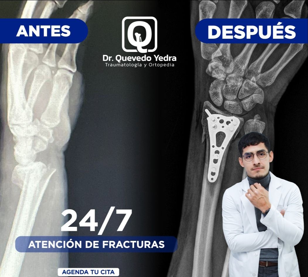 Eddy Quevedo Yedra-1